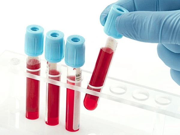 Blood Coagulation Tubes Market 2031| with Future Prospects, and Key ...