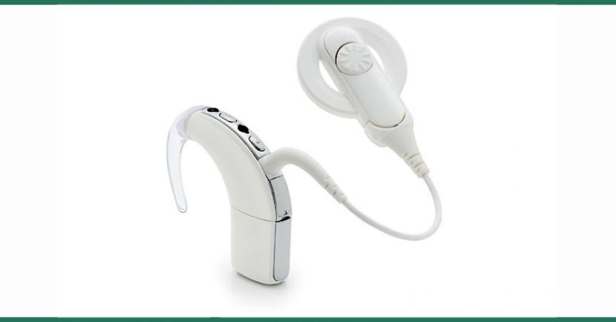 Cochlear Limited Is Expecting An Increase Of 8-12% In The Net Profit Of FY 2019