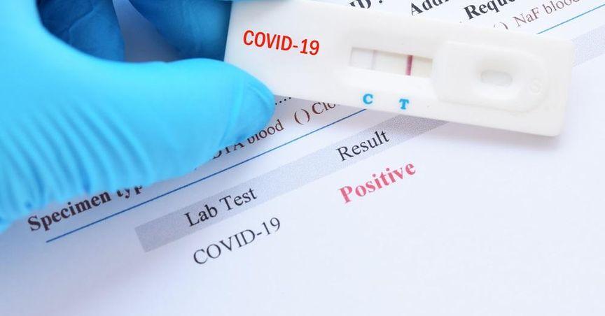  Why Is (ASX:RMD) Drawing Attention in 2026? 