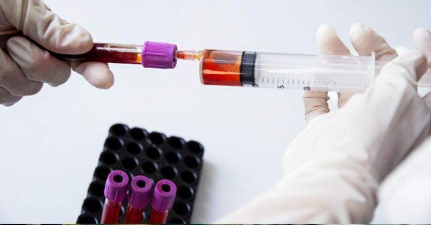  Imugene Reports Dosing Of First Patient In The HER-Vaxx Cancer Vaccine Phase 2 Study: Shares Rose Over 5% 