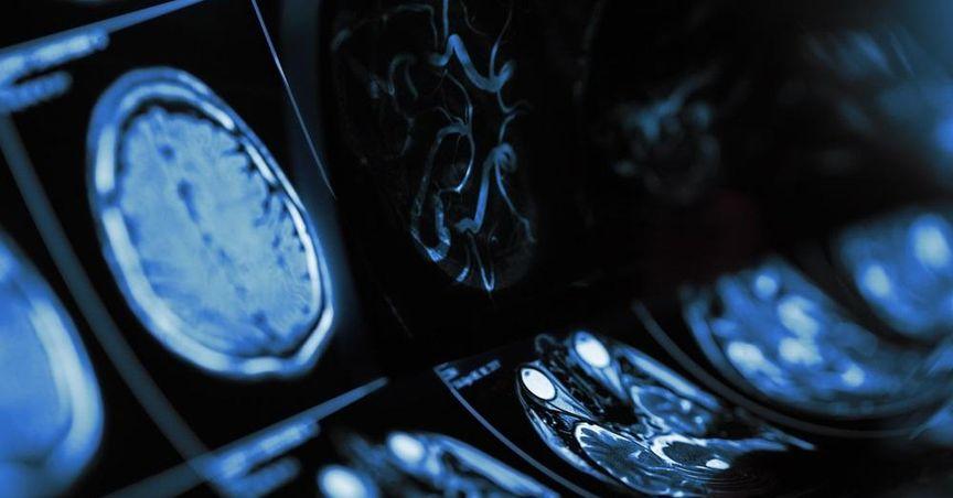 AstraZeneca Drug Advances Spark Strong Market Attention 