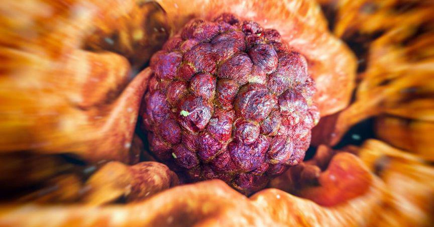  Radiopharm (ASX:RAD) unveils encouraging interim data for F-18 Pivalate in brain metastases 
