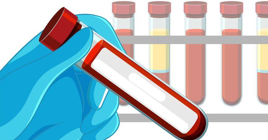  Arch Biopartners (TSXV:ARCH) Advances CS-AKI Trial and Completes Lipdro Acquisition 