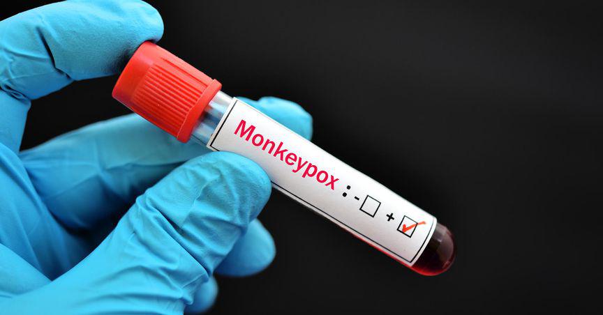  TSX stocks to buy as WHO considers declaring monkeypox global emergency 