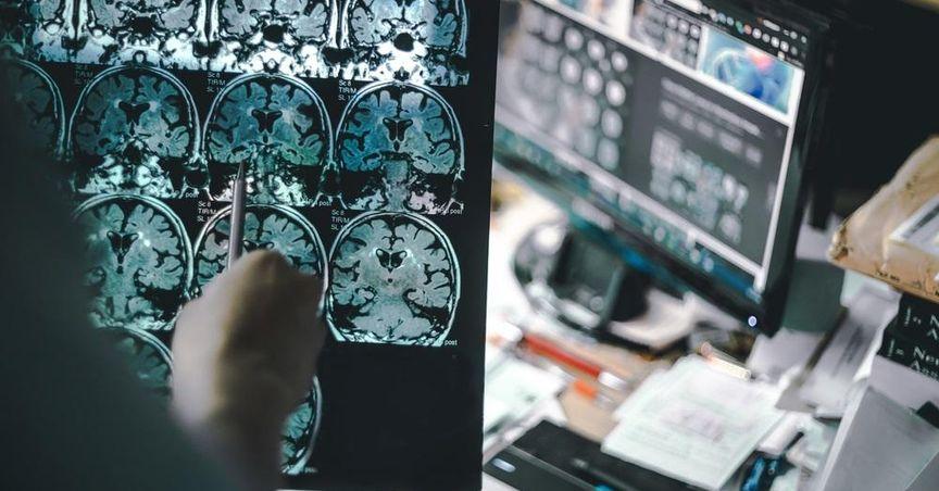  Breakthrough For NeuroSense As ALS Treatment Nears Early Approval 