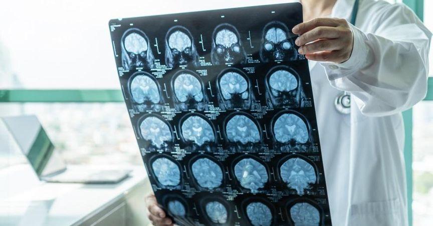  Telix Pharmaceuticals (ASX:TLX) Delivers Strong Q1 Growth with Revenue Surge and Strategic U.S. Expansion 