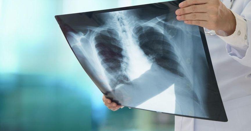  Telix (ASX:TLX): Why Is ASX Healthcare Finding Bright Spots? 