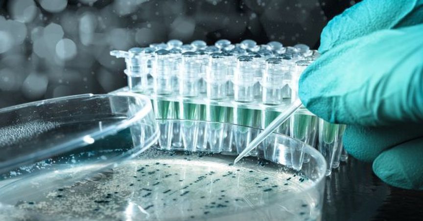  TBG Diagnostics Limited Inked A Deal With Zhangsha ZhangYe Medical- What You Need to Know 