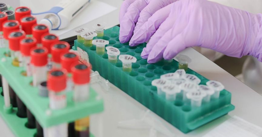  Why BARD1 Life Sciences Looks Lucrative To Investors? 
