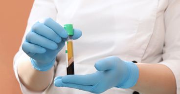 Convalescent plasma therapy for COVID-19: are there any benefits?
