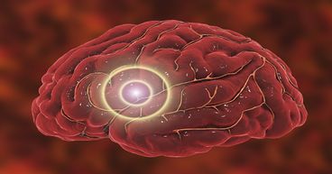 Clinuvel (ASX:CUV) shares upbeat results from afamelanotide drug trial