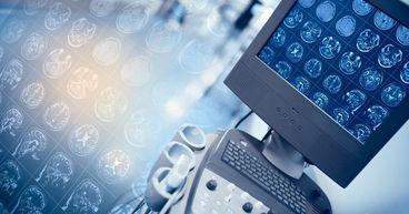 Why Pro Medicus Has the Market Watching Closely