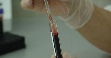 Chimeric Therapeutics (ASX:CHM) updates about fourth dose cohort in CHM 1101 study