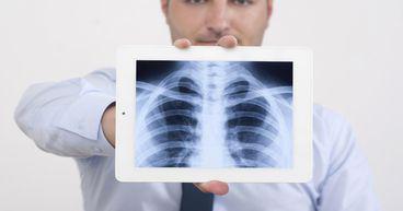 What’s driving 42% rally in 4DMedical (ASX:4DX) share price?
