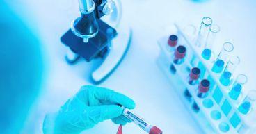 GSK to Acquire IDRx for $1.15 Billion, Strengthening Precision Therapeutics Portfolio