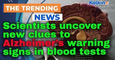 Scientists uncover new clues to Alzheimer’s warning signs in blood tests