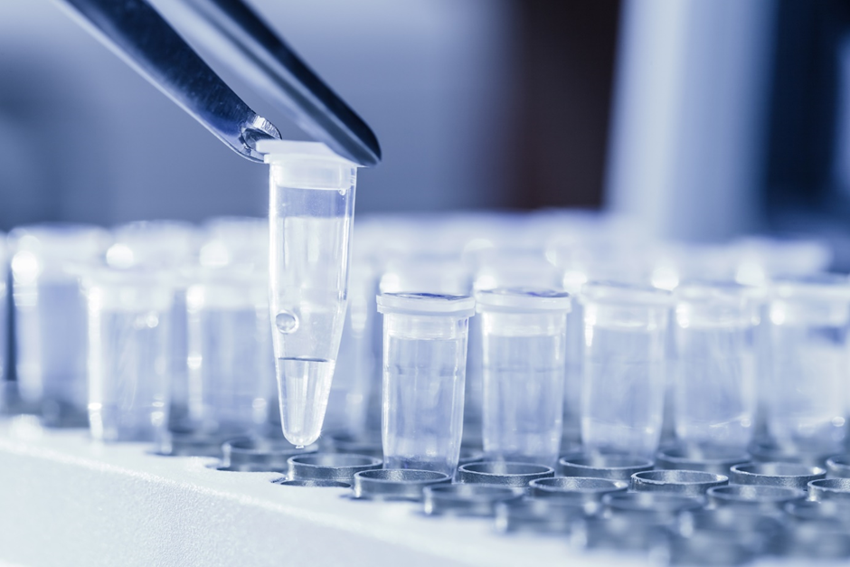 PCR test made mandatory by most countries