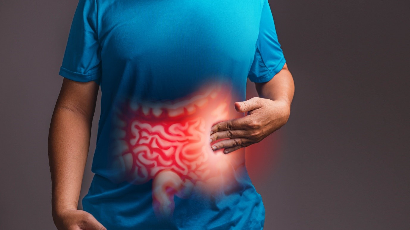 irritable bowel syndrome