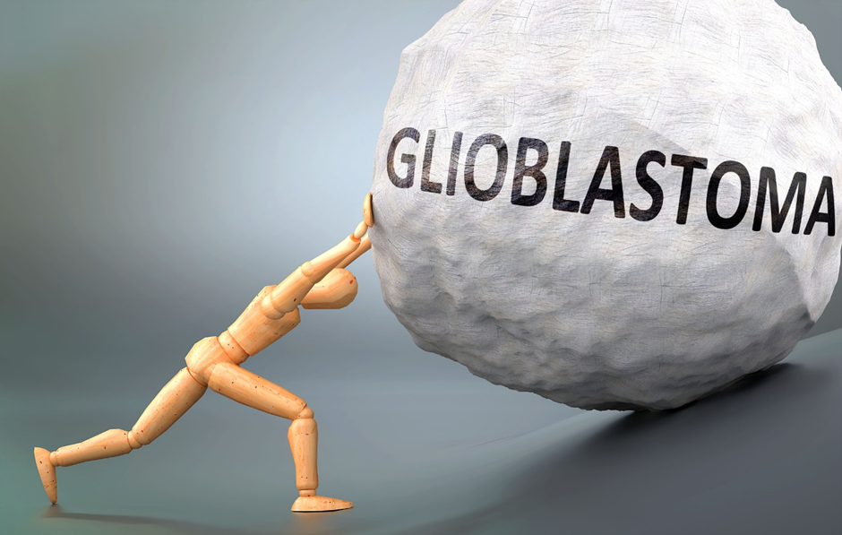 Glioblastoma is lead indication for Paxalisib