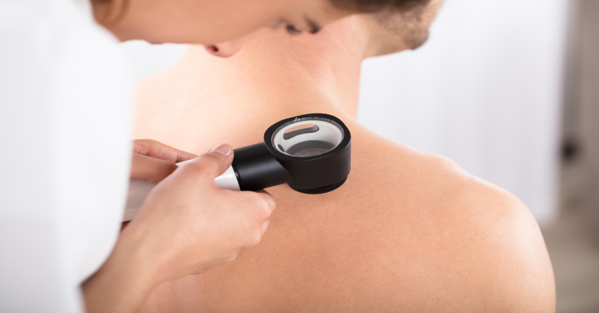 doctor examining skin of patient with dermatoscope