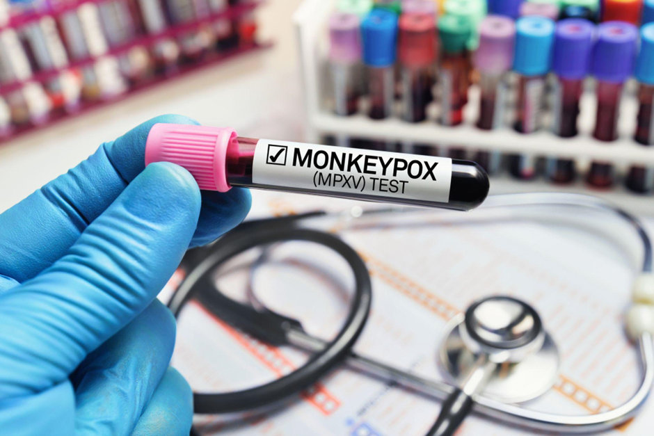 Monekypox