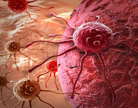 How far has Invion’s (ASX:IVX) cancer treatment progressed?