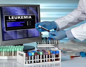 Race Oncology (ASX:RAC) shares jump on positive Zantrene AML trial results