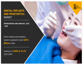 Dental Implants and Prosthetics Market Insights: Bridging Gaps in Dentistry | CAGR 12.4%