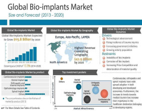 Bio-Implants Market Poised for Rapid Growth as Demand Surges Worldwide | CAGR of 10.3%
