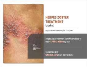 Herpes Zoster Treatment Market Updates : Latest Innovation , Investment Strategies, and Forecast 2021-2030