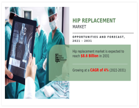 Hip Replacement Market Booms: Set to Surge to $8.6 Billion by 2031 | CAGR of 4%