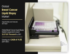 Breast Cancer Liquid Biopsy Market Is Projected To Reach $357.05 Million by 2027 | CAGR 19.2%