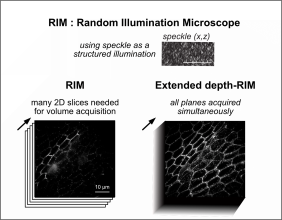 Fast super-resolved microscopy with a structured illumination and extended depth detection