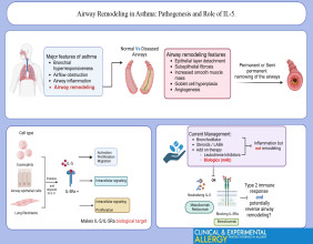 Monoclonal antibodies have the potential to treat severe asthma bouts, scientists find