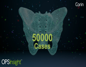 Corin Celebrates 50,000 OPS™ Cases, Advancing the Future of Personalized Hip Arthroplasty