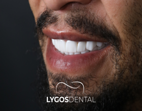 Dental Aesthetics in Turkey: Zirconium Crown and Teeth Whitening Trends