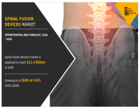 Spinal Fusion Devices Market Set to Surge to $11.43 Billion by 2030 at a 4.6% CAGR
