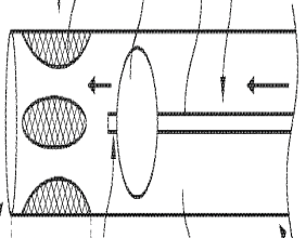 Retriever Medical Receives Patent for Innovative Aspiration Catheter Concept