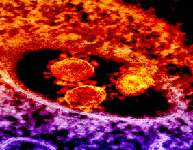 Lipid Nanosciences is Advancing 'GC101' to Proof of Concept/Preclinical Studies with a Potential New Research Partner