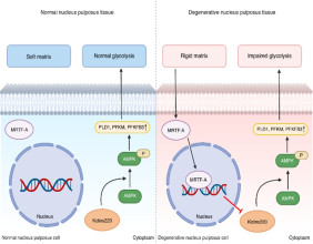 Matrix stiffness and energy crisis in spinal discs: a new pathway to combat degeneration