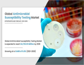 Antimicrobial Susceptibility Testing Market Predicted to Reach $4.73 Billion by 2030 | CAGR of 5.8%