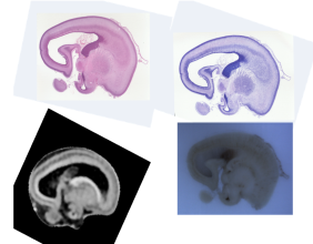 Indian Researchers release most detailed 3D Cell-Resolution images of human fetal brain