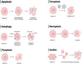New Avenues in Breast Cancer Treatment: The Role of Ubiquitin-Specific Proteases in Programmed Cell Death
