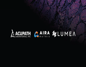 Lumea, AIRA Matrix, and Acupath partnered to provide a Diagnostic AI Solution for the URO17® Bladder Cancer Biomarker