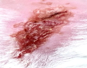 Ruvidar Effective in the Treatment of Herpes