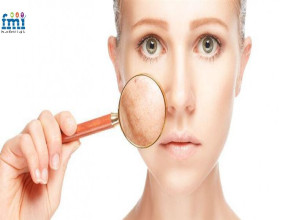 Global Hyperpigmentation Treatment Market Set to Surpass USD 12.4 Million by 2035 reflecting a CAGR of 9.0% | FMI