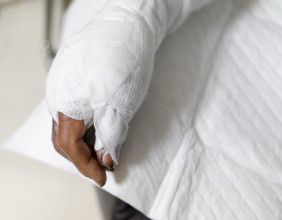 Legal Considerations for Burn Injury Victims in Louisiana Workplaces