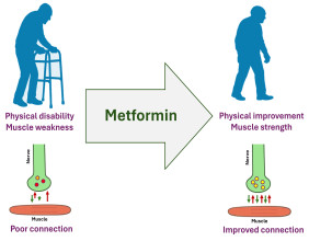 Metformin could treat health conditions of old people, particularly those with functional disability, study finds