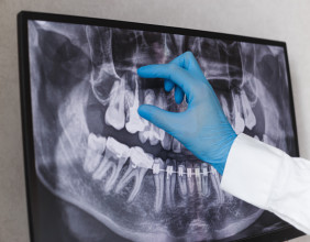 Recognizing When Periodontal Deep Cleaning May Be Needed Over Routine Dental Checkups, Says Slidell-Based Dentist