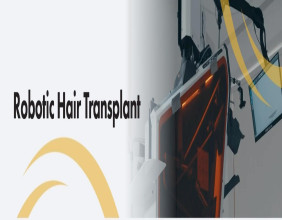 Automation Meets Aesthetics: Este Medical Group Rolls Out Robotic DHI Hair Restoration in Birmingham